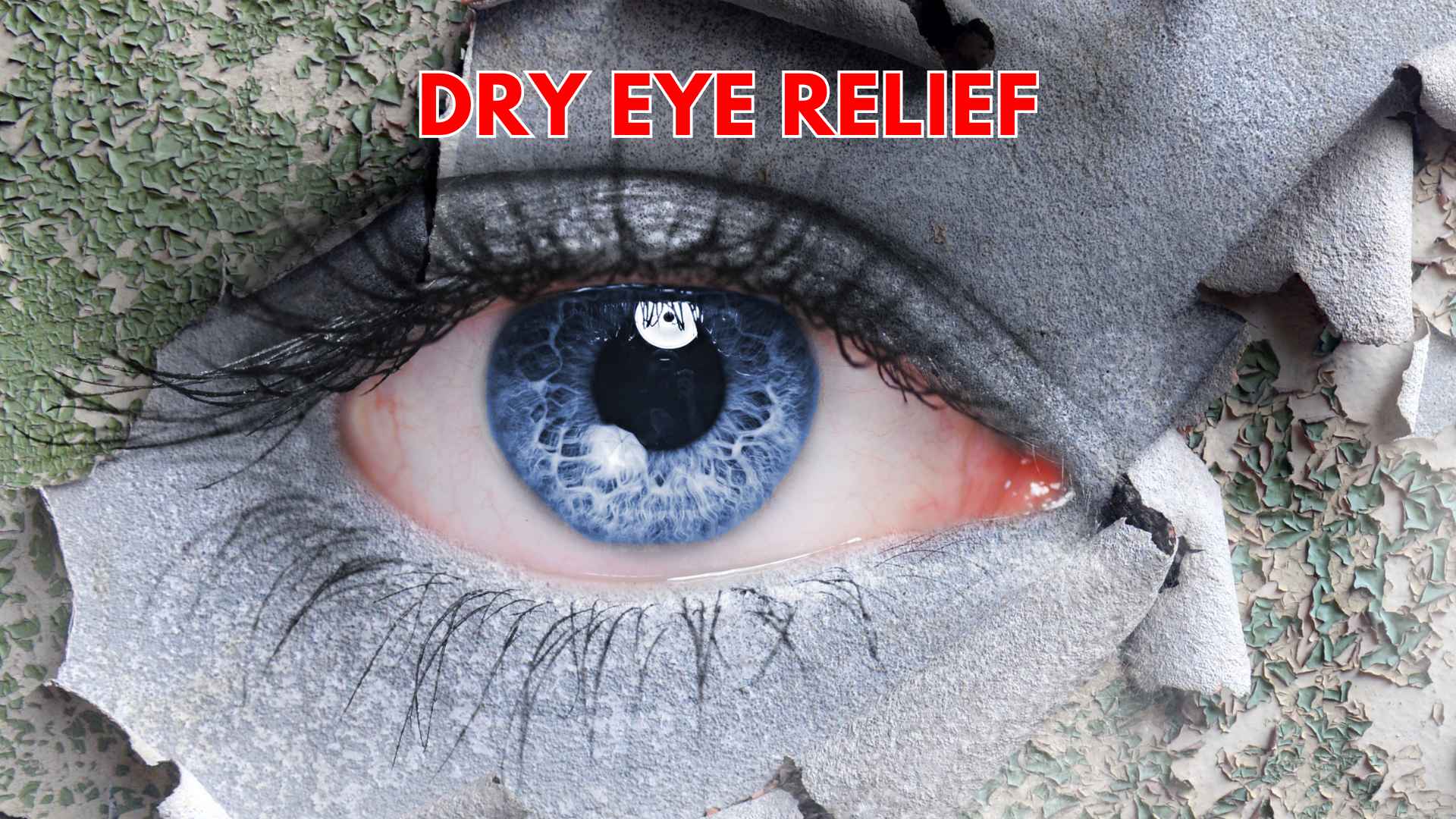 Dry eye relief